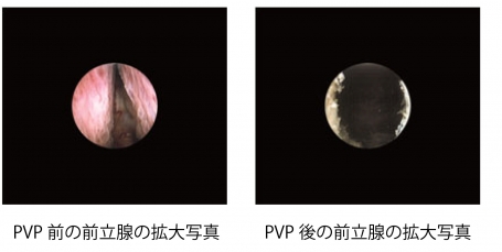 拡大写真
